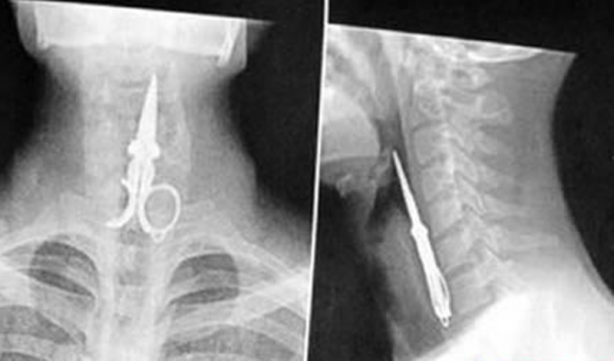 Foto - Röntgen sonrası çıkanlar doktorları bile şok etti! İşte açıklanamayan o görüntüler