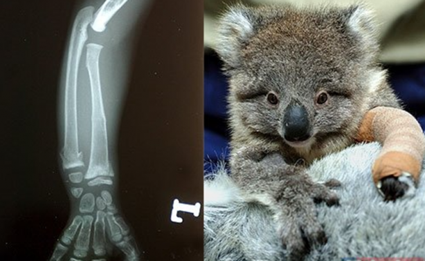 Foto - Röntgen sonrası çıkanlar doktorları bile şok etti! İşte açıklanamayan o görüntüler