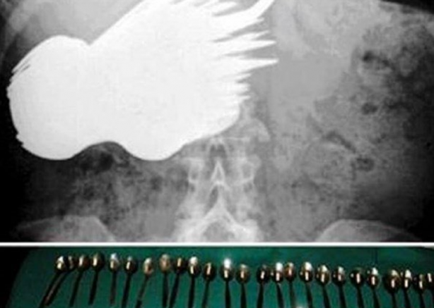 Foto - Röntgen sonrası çıkanlar doktorları bile şok etti! İşte açıklanamayan o görüntüler