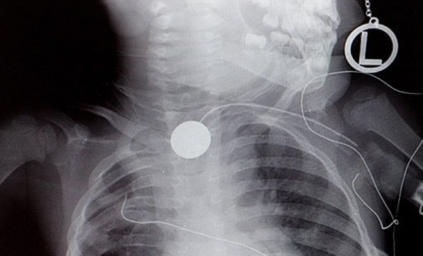 Foto - Röntgen sonrası çıkanlar doktorları bile şok etti! İşte açıklanamayan o görüntüler