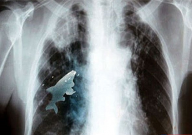 Foto - Röntgen sonrası çıkanlar doktorları bile şok etti! İşte açıklanamayan o görüntüler