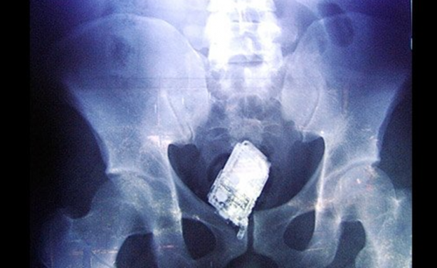 Foto - Röntgen sonrası çıkanlar doktorları bile şok etti! İşte açıklanamayan o görüntüler