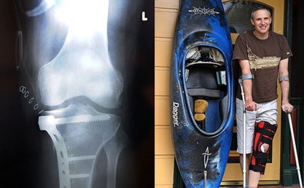 Foto - Röntgen sonrası çıkanlar doktorları bile şok etti! İşte açıklanamayan o görüntüler