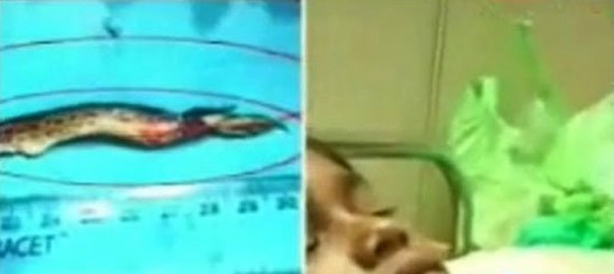 Foto - Röntgen sonrası çıkanlar doktorları bile şok etti! İşte açıklanamayan o görüntüler