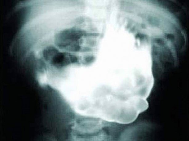 Foto - Röntgen sonrası çıkanlar doktorları bile şok etti! İşte açıklanamayan o görüntüler