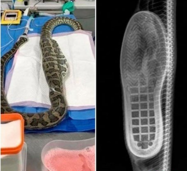 Foto - Röntgen sonrası çıkanlar doktorları bile şok etti! İşte açıklanamayan o görüntüler