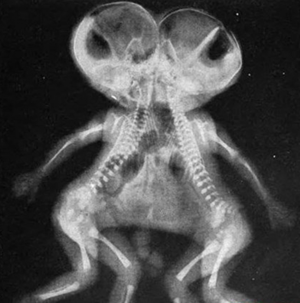 Röntgen sonrası çıkanlar doktorları bile şok etti! İşte açıklanamayan o görüntüler