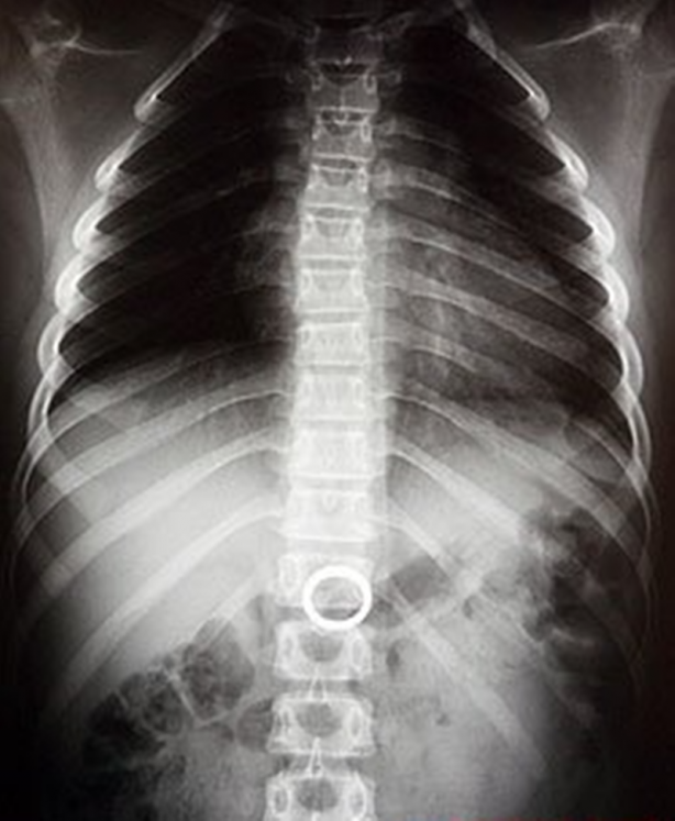 Foto - Röntgen sonrası çıkanlar doktorları bile şok etti! İşte açıklanamayan o görüntüler