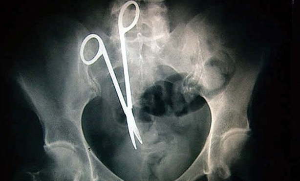 Foto - Röntgen sonrası çıkanlar doktorları bile şok etti! İşte açıklanamayan o görüntüler