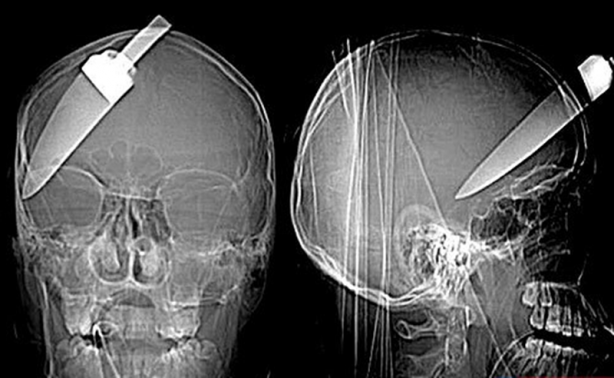 Foto - Röntgen sonrası çıkanlar doktorları bile şok etti! İşte açıklanamayan o görüntüler