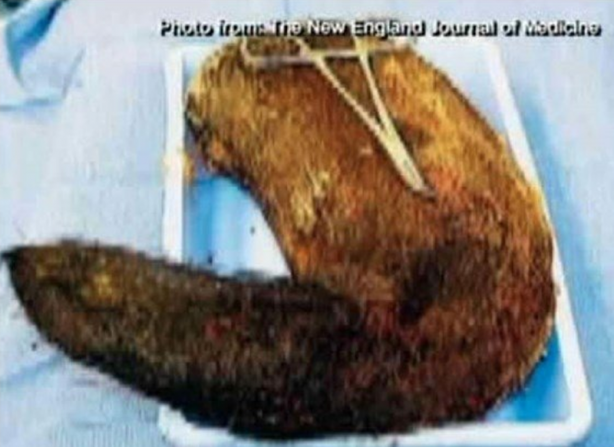 Foto - Röntgen sonrası çıkanlar doktorları bile şok etti! İşte açıklanamayan o görüntüler