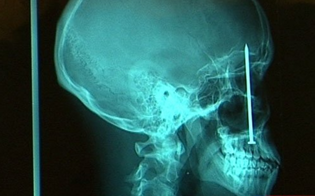 Foto - Röntgen sonrası çıkanlar doktorları bile şok etti! İşte açıklanamayan o görüntüler