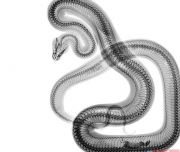 Foto - Röntgen sonrası çıkanlar doktorları bile şok etti! İşte açıklanamayan o görüntüler