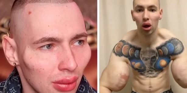 Foto - Rus askeri: Uzaylıya benzemek için defalarca bıçak altına yattı