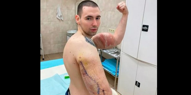 Foto - Rus askeri: Uzaylıya benzemek için defalarca bıçak altına yattı