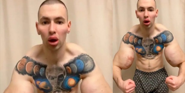 Foto - Rus askeri: Uzaylıya benzemek için defalarca bıçak altına yattı