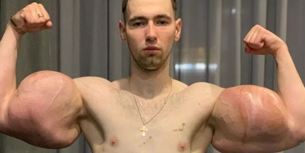 Foto - Rus askeri: Uzaylıya benzemek için defalarca bıçak altına yattı