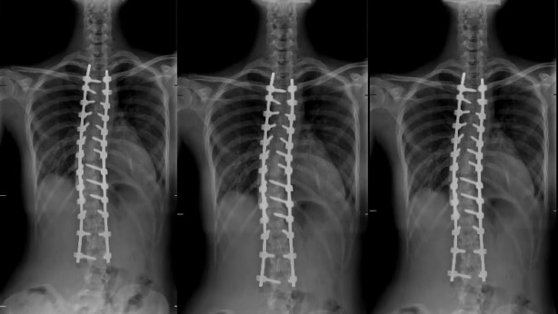 Foto - Rus kız bütün Avrupa'da çare aradı! Sadece Türkiye'de yüzü güldü