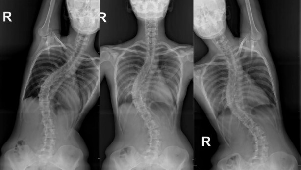 Rus kız bütün Avrupa'da çare aradı! Sadece Türkiye'de yüzü güldü