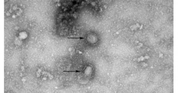 Foto - Rus uzman koronavirüsün en tuhaf özelliğini açıkladı