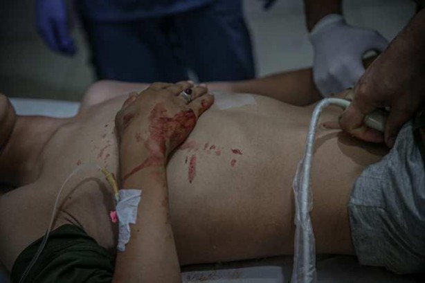 Foto - Rusya İdlib'de sivilleri bombaladı