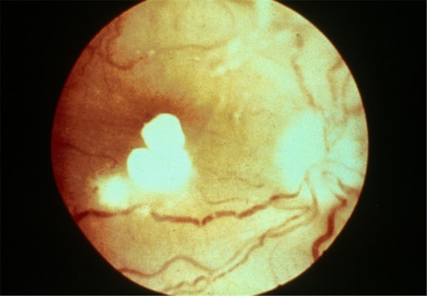 Foto - Sabah kalktığınızda bir bardak suya tükürün ve...