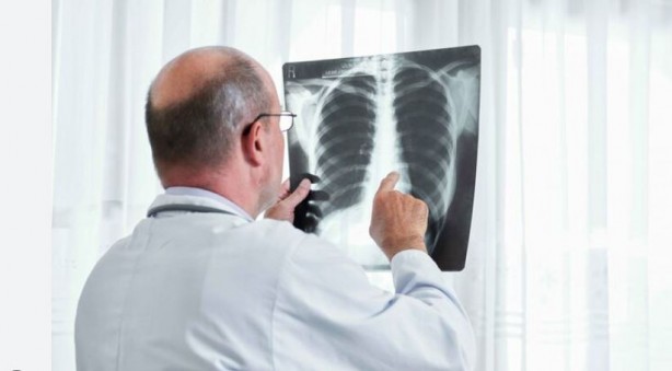 Foto - Sabah saatlerinde bu belirtiler kanser habercisi