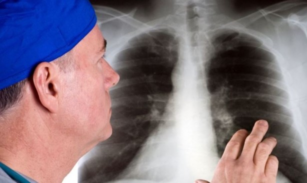 Sabah saatlerinde bu belirtiler kanser habercisi