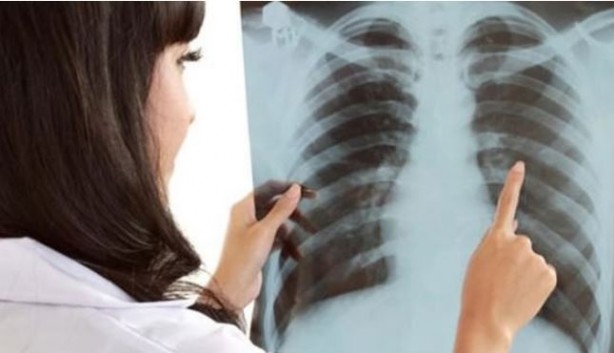 Foto - Sabah saatlerinde bu belirtiler kanser habercisi