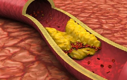 Foto - Sabahları Türk kahvenize 1 kaşık ekleyin! 1 ayda 5 beden birden inceltiyor... Diğerleri sağlığını bozdu ise dene