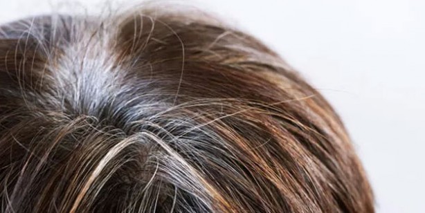 Foto - Saç beyazlamasına neden olan gıdalar