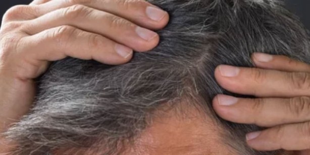 Foto - Saç beyazlamasına neden olan gıdalar