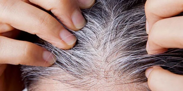 Foto - Saç beyazlamasına neden olan gıdalar