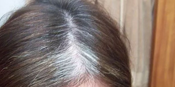 Foto - Saç beyazlamasına neden olan gıdalar