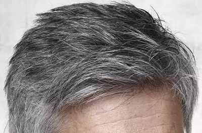 Foto - Saç beyazlamasına neden olan gıdalar