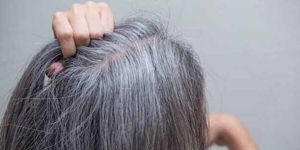 Foto - Saç beyazlamasına neden olan gıdalar