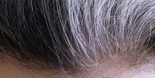 Foto - Saç beyazlamasına neden olan gıdalar