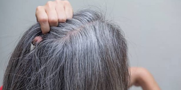 Foto - Saç beyazlamasına neden olan gıdalar