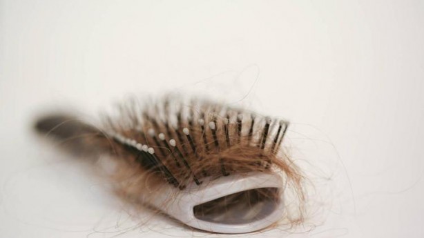 Foto - Saç diplerindeki egzama, kaşıntı ve iltihaplanmayı kökten çözüyor! Şampuanın içine 1 damla ekleyin