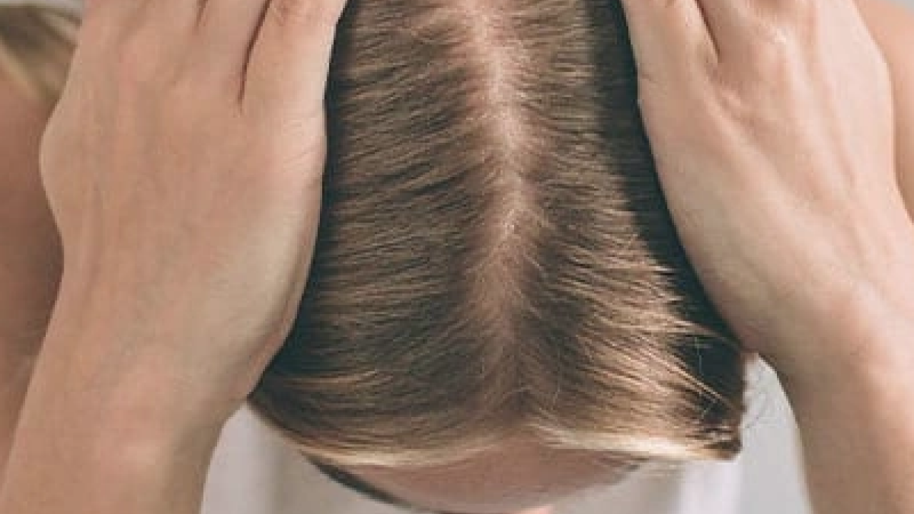 Foto - Saç diplerindeki egzama, kepek ve kaşıntının çaresi! Çözümü son derece kolay: 1 damlası kafa derisini rahatlatıyor