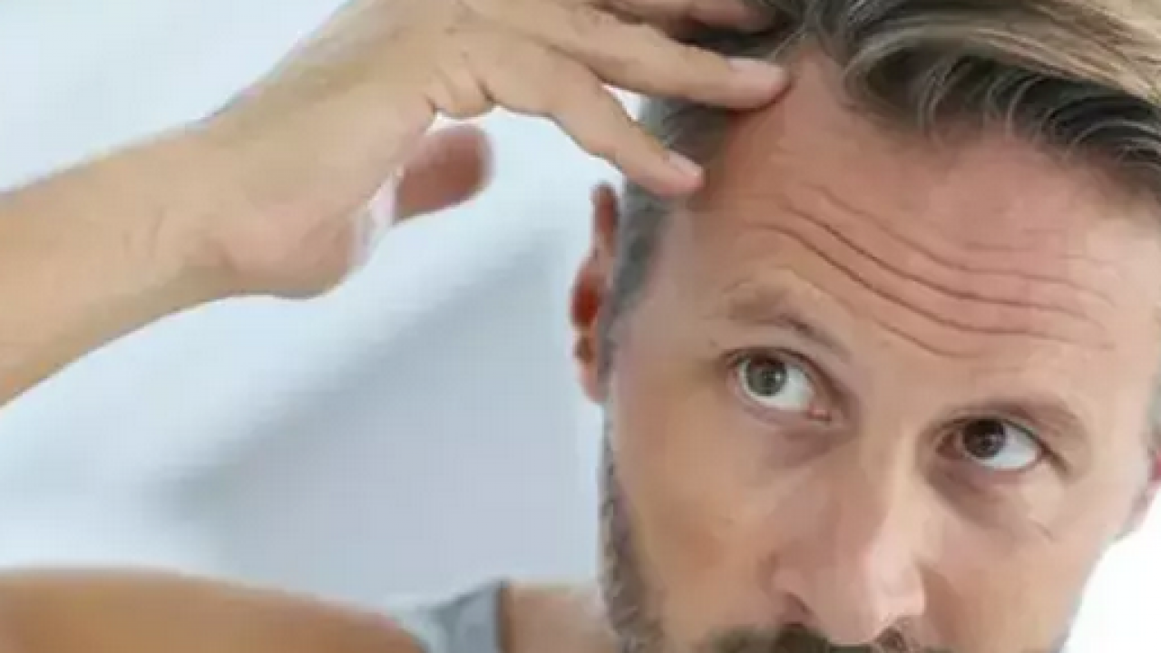 Foto - Saç diplerindeki egzama, kepek ve kaşıntının çaresi! Çözümü son derece kolay: 1 damlası kafa derisini rahatlatıyor