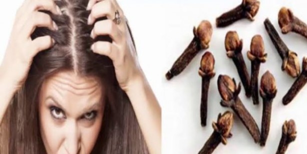Saç dökülmesinden karanfil kürü yaparak kurtulun