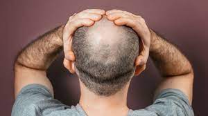 Foto - Saç dökülmesine evde doğal ve bitkisel çözüm: Saçı kökünden çoşturan lavanta suyu bakın ne işe yarıyor!