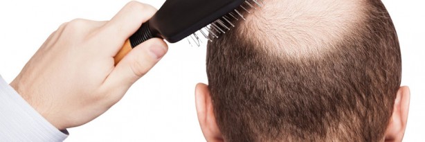 Foto - Saç dökülmesini azaltan 4 muhteşem yöntem