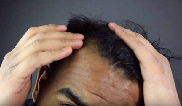 Foto - Saç dökülmesini engelleyen besinler