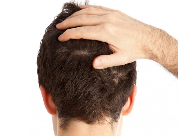 Foto - Saç dökülmesini engelleyen besinler