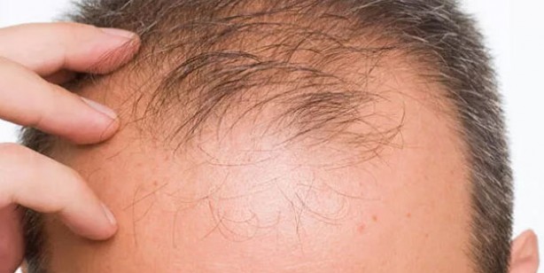 Saç dökülmesini engelleyen besinler