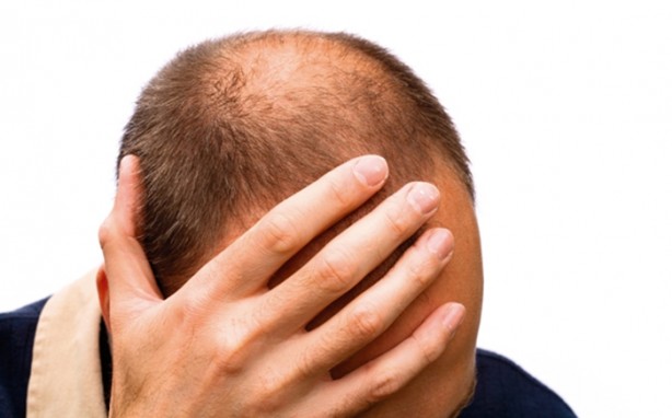 Foto - Saç dökülmesini önlemek istiyorsanız...