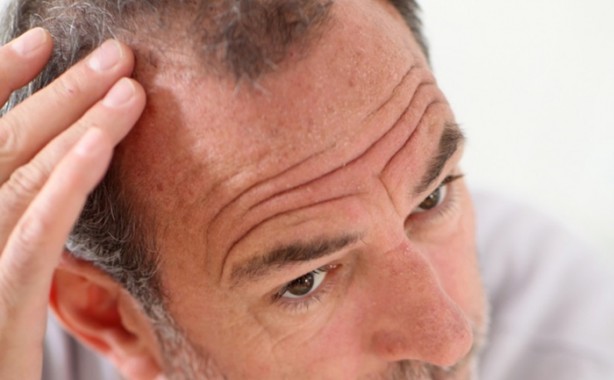 Foto - Saç dökülmesini önlemek istiyorsanız...