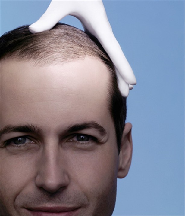 Foto - Saçı dökülenler dikkat!